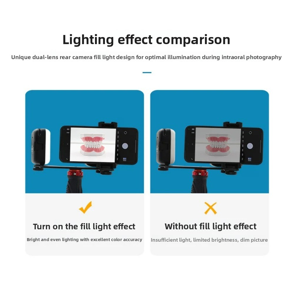 歯科用撮影ライト、スマートフォン用Bluetooth LED - Photography Basic のレビューと価格